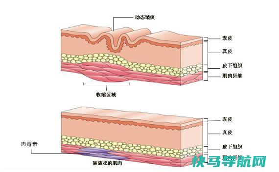 面部皱纹出现的顺序是样的？皱纹的分类